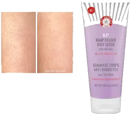Exfoliante Corporal